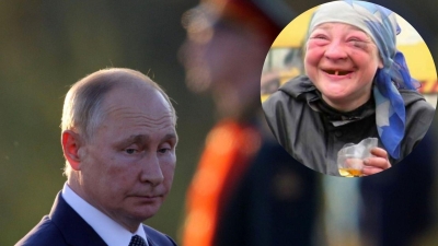 В Рязани 24-летний водитель электровелосипеда получил травмы в ДТП